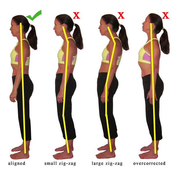 Do You Have Good Posture?  APC Physiotherapy and Sports Clinic