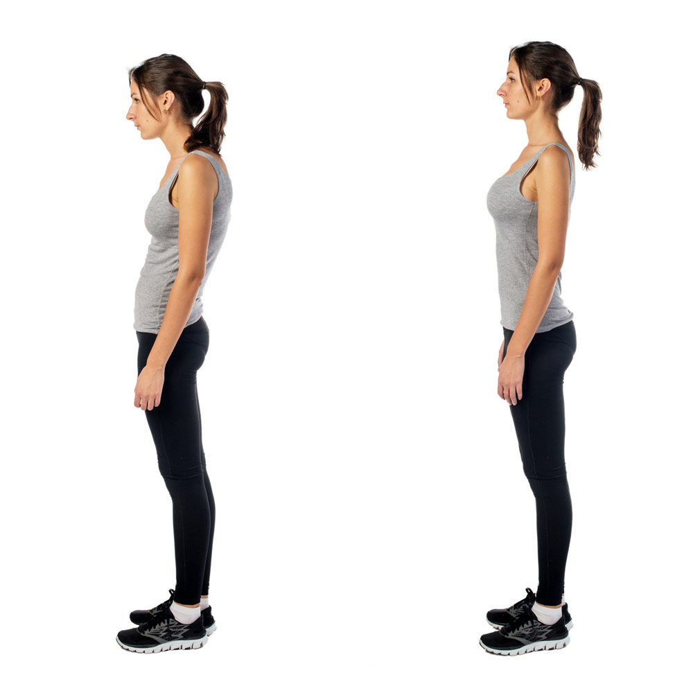 Posture Correction Toronto | Synergy Rehabilitation Clinic Chiropractic